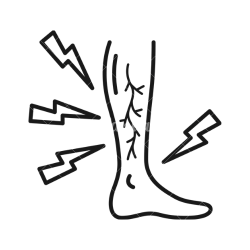 ВЕНОЗНАЯ НЕДОСТАТОЧНОСТЬ