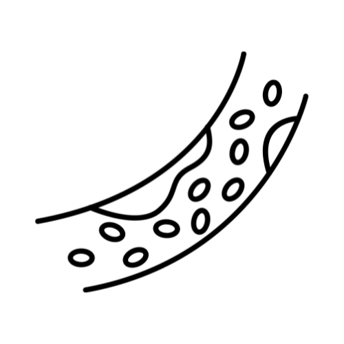 ХОЛЕСТЕРИН